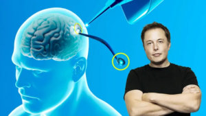 Neuralink anuncia el éxito del primer chip cerebral en un ser humano: ¿qué significa?