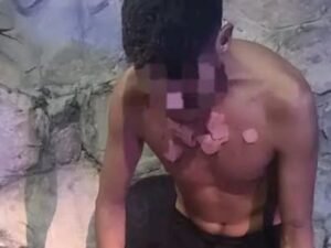Detuvieron a una mujer que prendió fuego a una persona en situación de calle